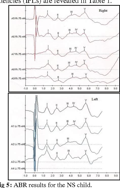 abr results|abr test results.